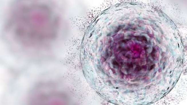 Pemberian Autologus Stem Cell Jadi Alternatif Pengobatan bagi Pasien Autoimun yang dimaksud Ketergantungan Steroid