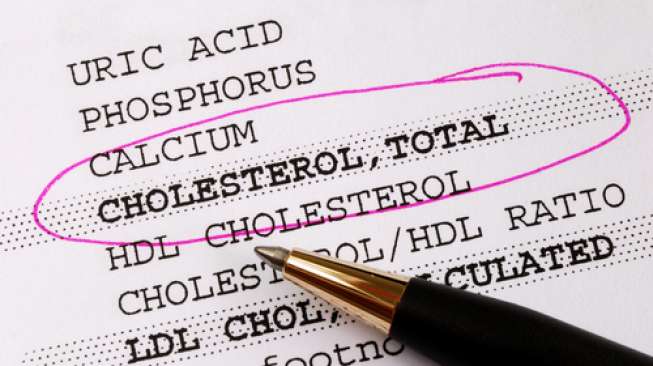 4 Cara Cegah Kolesterol Kambuh Setelah Pulang Liburan, Dokter Ingatkan Lagi Soal Makanan